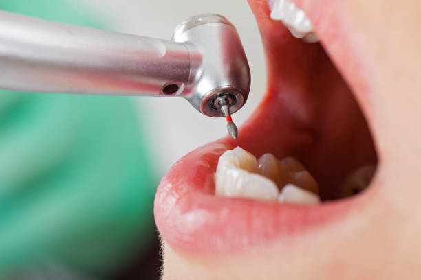Best Root Canal Emergency Dentist  in Homosassa Springs, FL